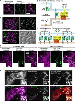 Frontiers | Improved Split-GFP Systems For Visualizing Organelle ...